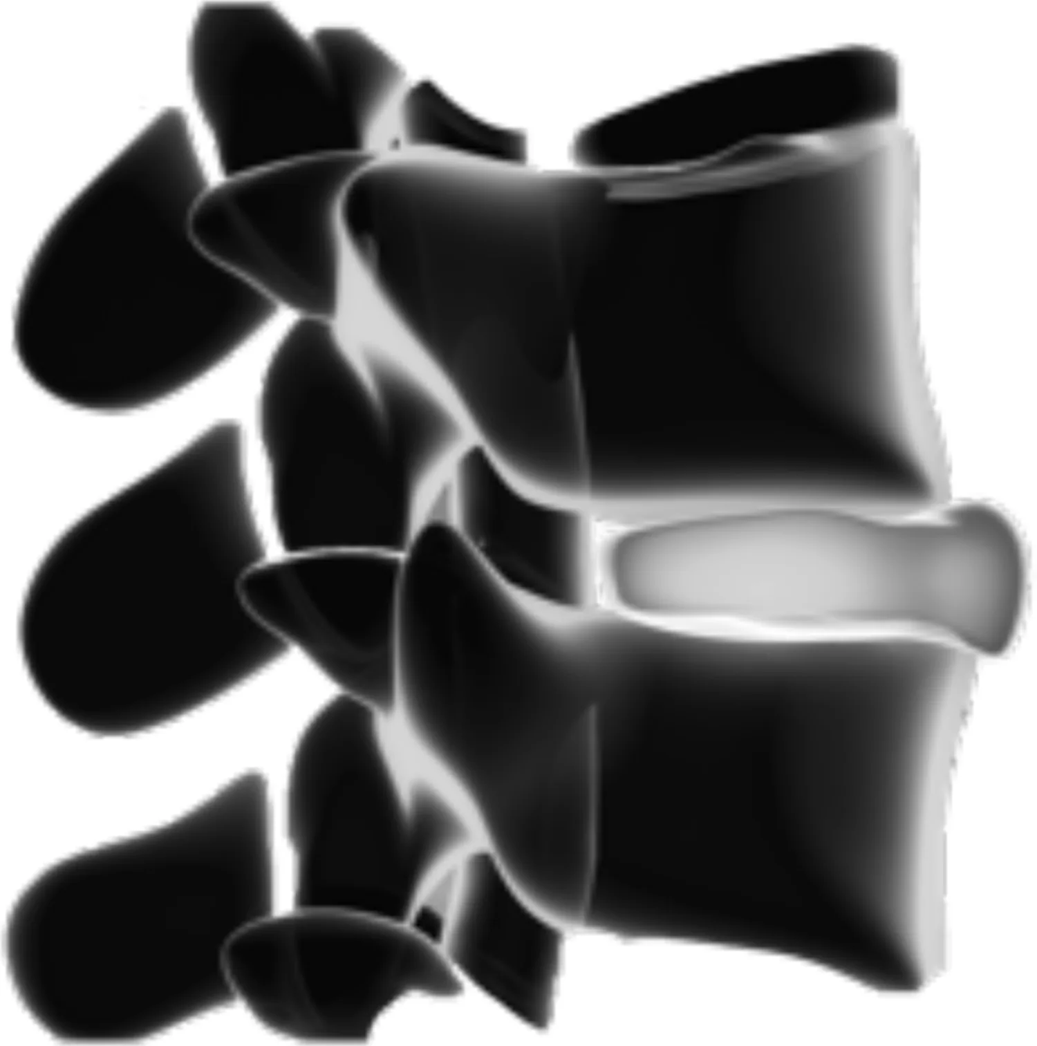 Rendu 3D d'un segment vertébral (état de référence)